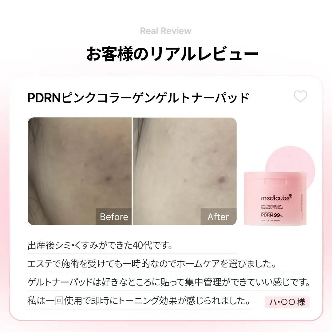 PDRNコラーゲントーニングゲルトナーパット/MEDICUBE/トナーパッドを使ったクチコミ(6枚目)