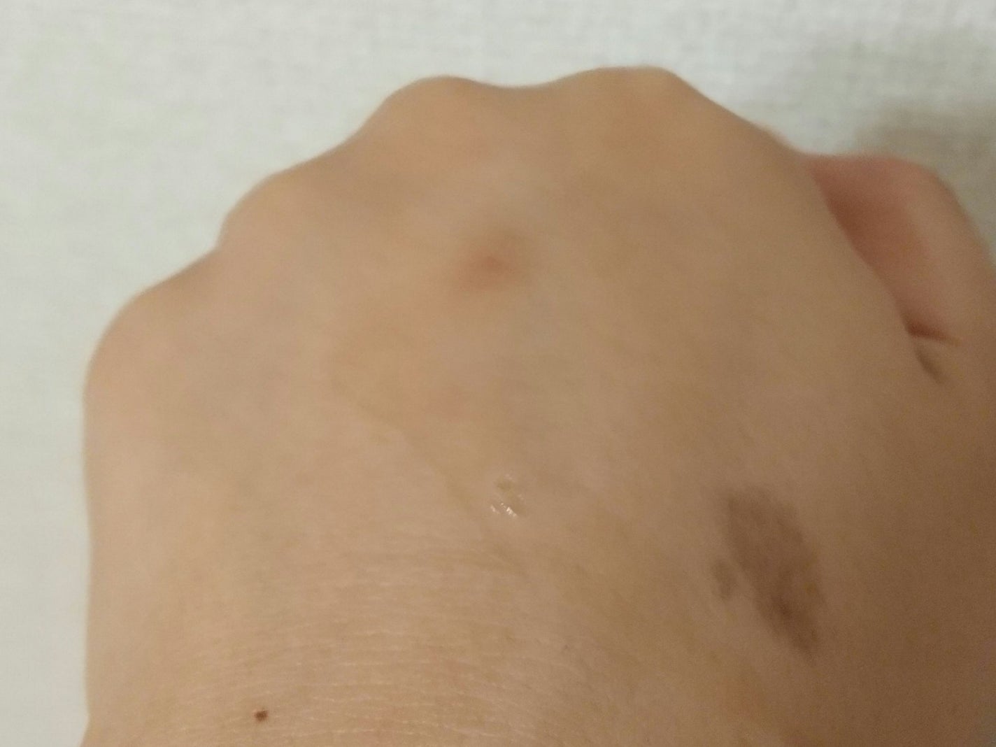 G2 ブライトニング アンプル/VT/美容液を使ったクチコミ(5枚目)