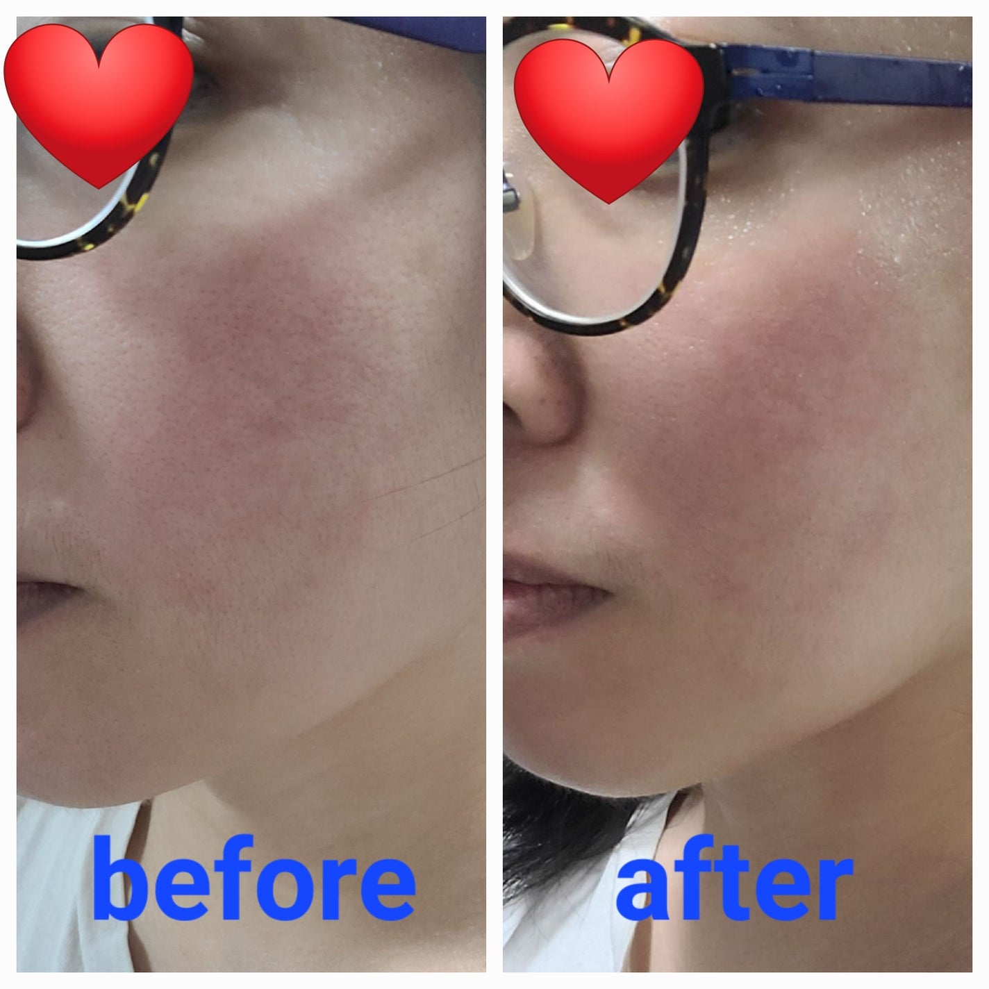 グルタチオンフィルムコラーゲンマスク/Abib /シートマスク・パックを使ったクチコミ(4枚目)