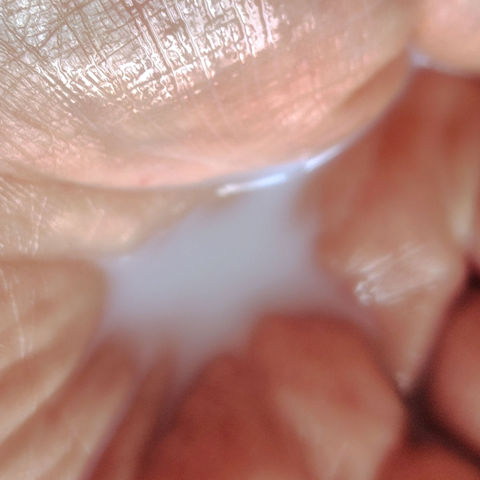 薬用雪肌精 ブライトニング エッセンス ローション/雪肌精/化粧水を使ったクチコミ（3枚目）