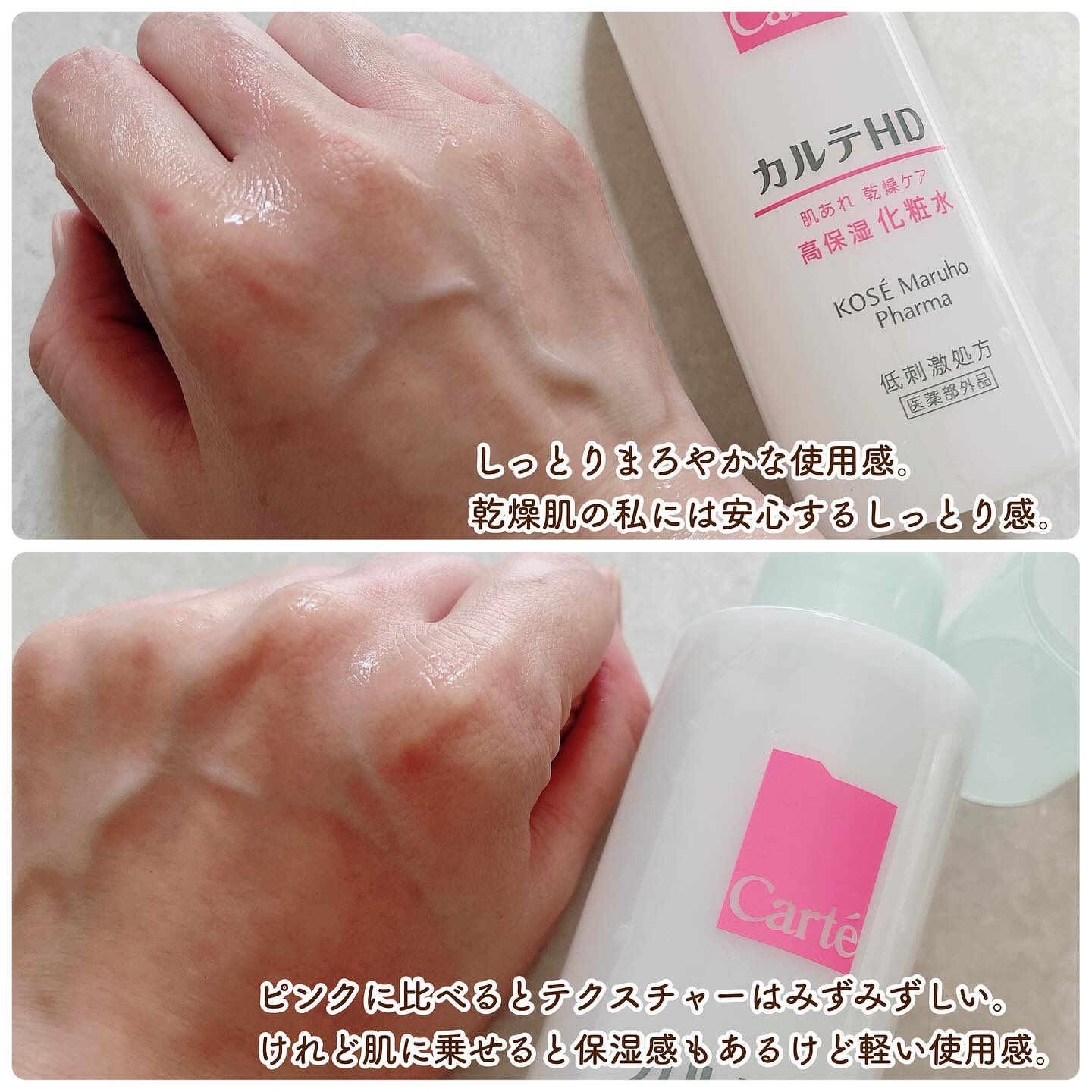 モイスチュア ローション/カルテHD/化粧水を使ったクチコミ（3枚目）