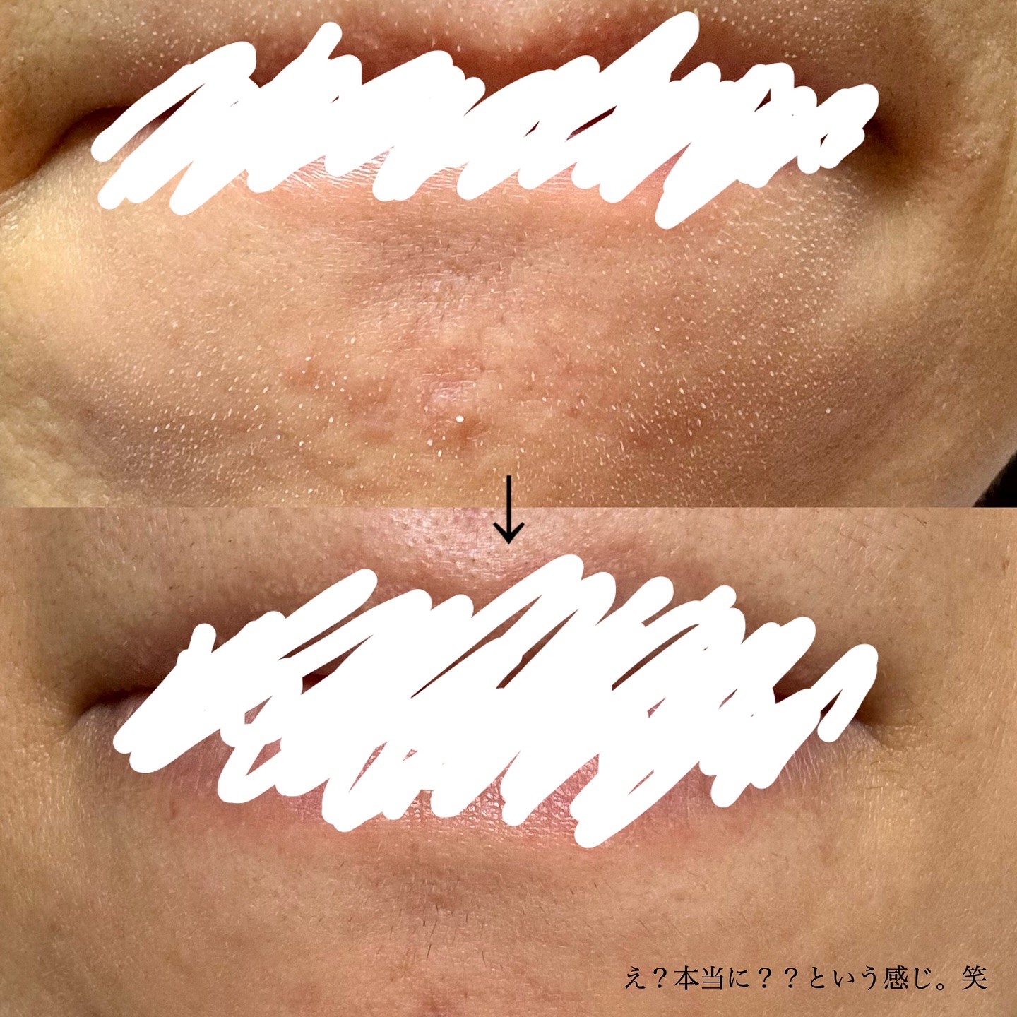 AQ 毛穴美容液オイル/DECORTÉ/フェイスオイルを使ったクチコミ（3枚目）