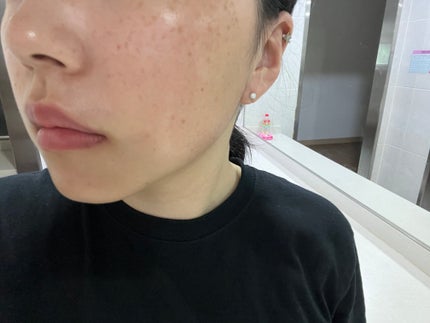 エアリーライト 透明UVスティック/COSRX/日焼け止めスティックを使ったクチコミ(5枚目)