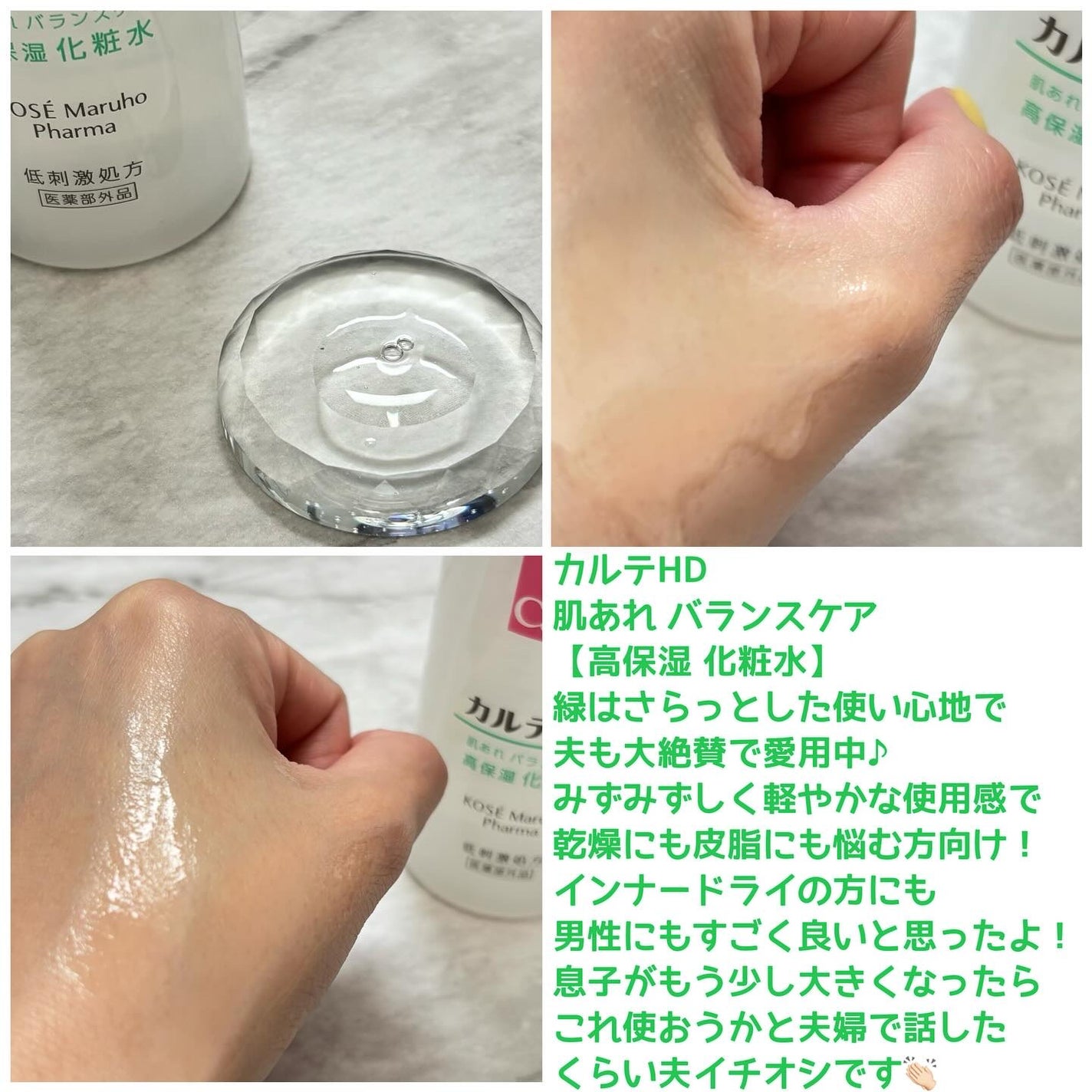 モイスチュア ローション/カルテHD/化粧水を使ったクチコミ(4枚目)