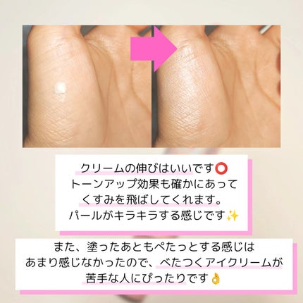 ごめんね素肌 クマらないアイクリーム/クリアターン/アイケア・アイクリームを使ったクチコミ(5枚目)