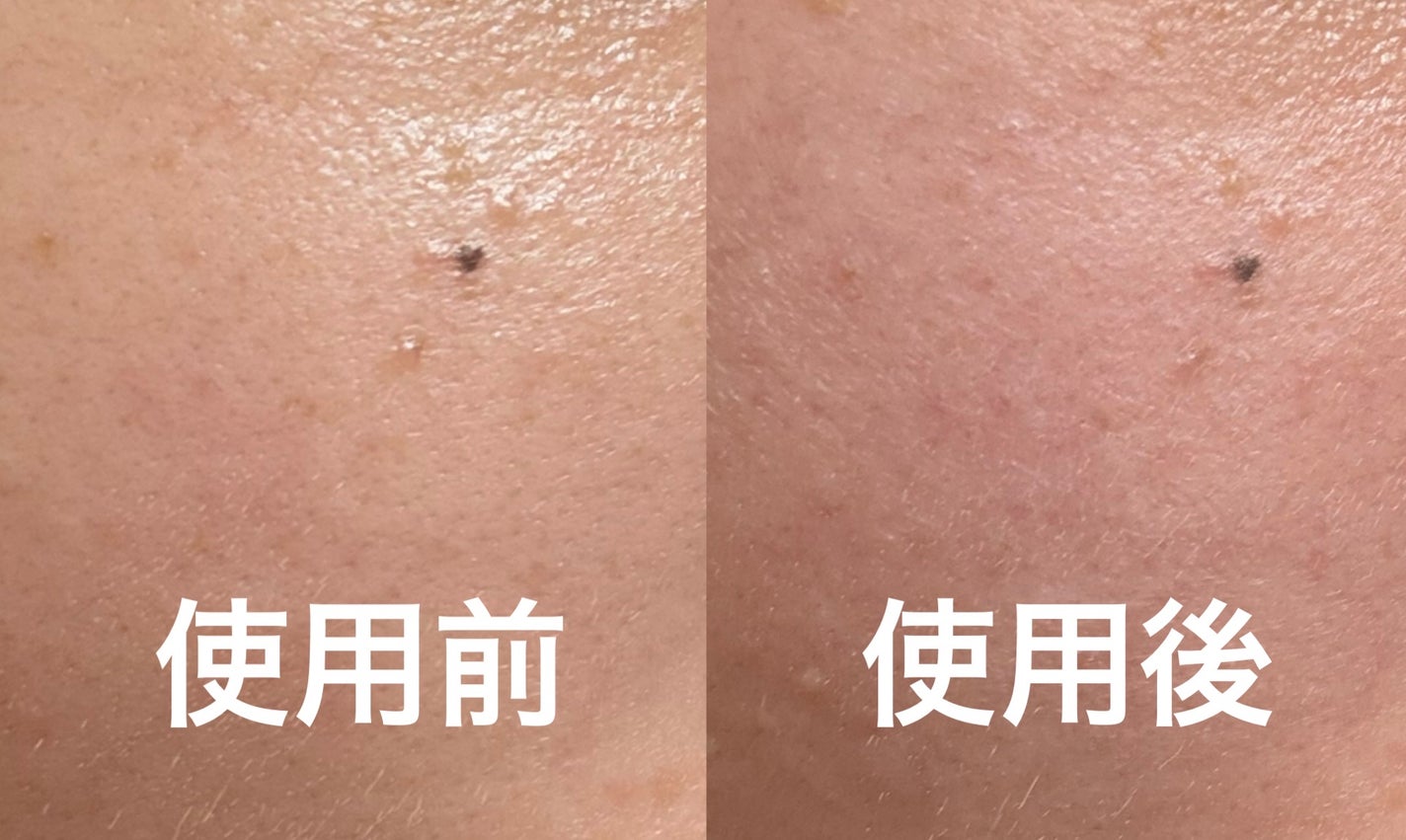 ビタミンC エキスパート40% マスクコンセントレート/IOPE/フェイスクリームを使ったクチコミ(4枚目)