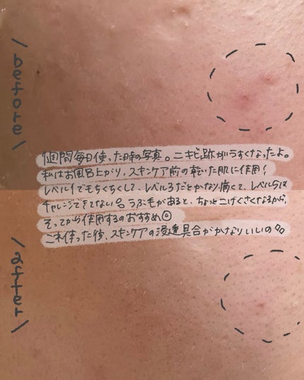 ポアタイトニングブーストセラム/CELORABY/美容液を使ったクチコミ(3枚目)
