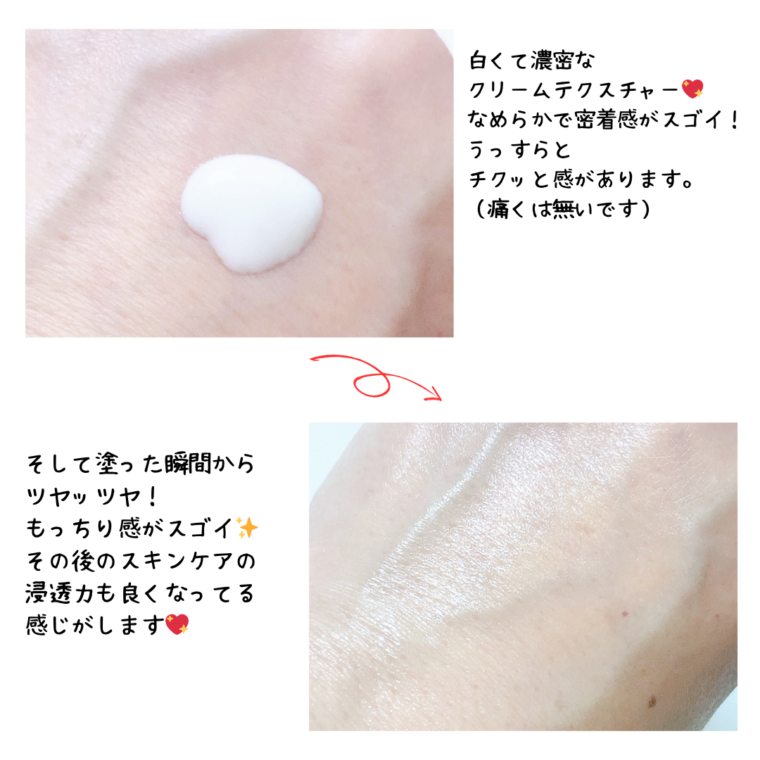 PDRN+リードルS 100/VT/美容液を使ったクチコミ（2枚目）