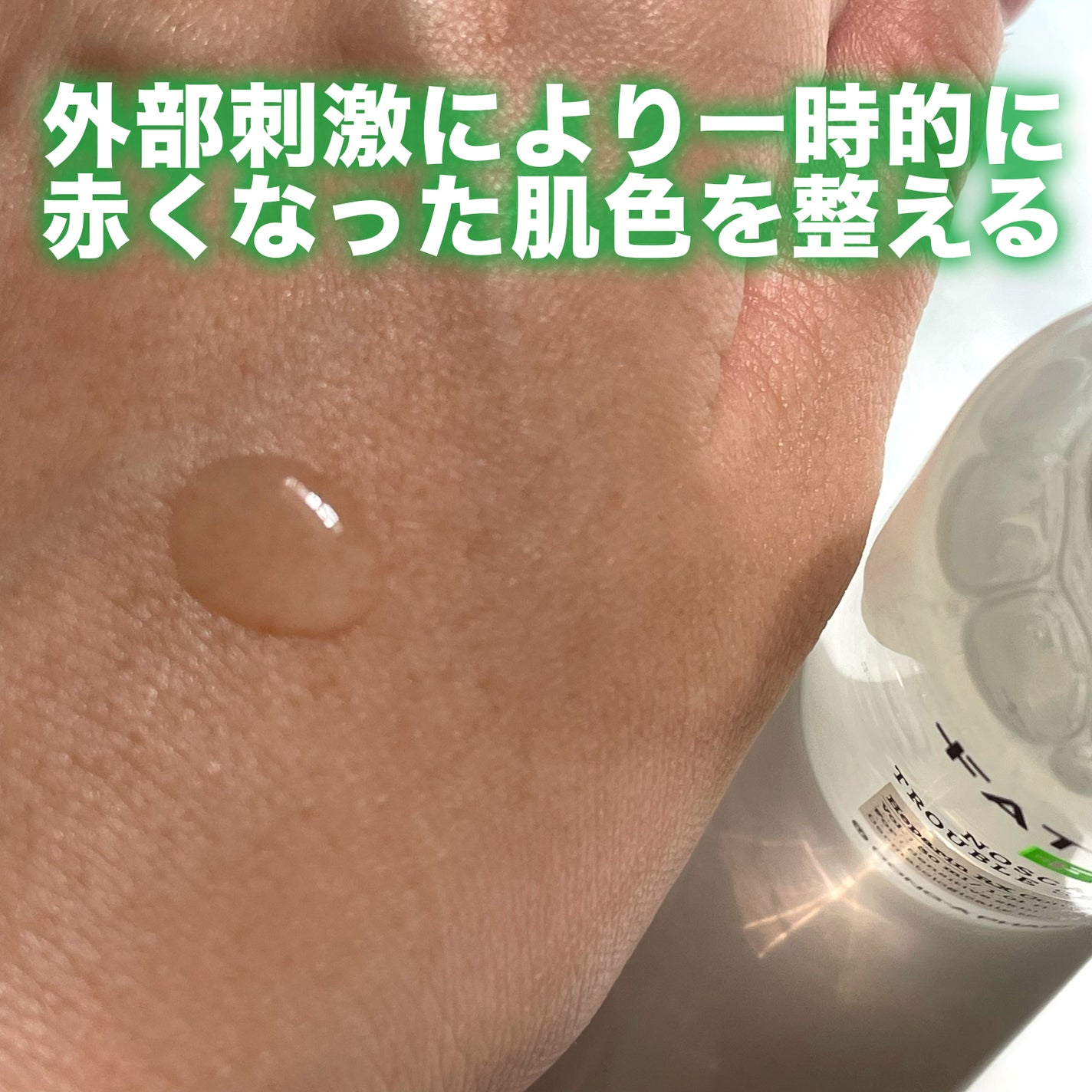 ノスカナイン トラブル セラム/FATION/美容液を使ったクチコミ(3枚目)