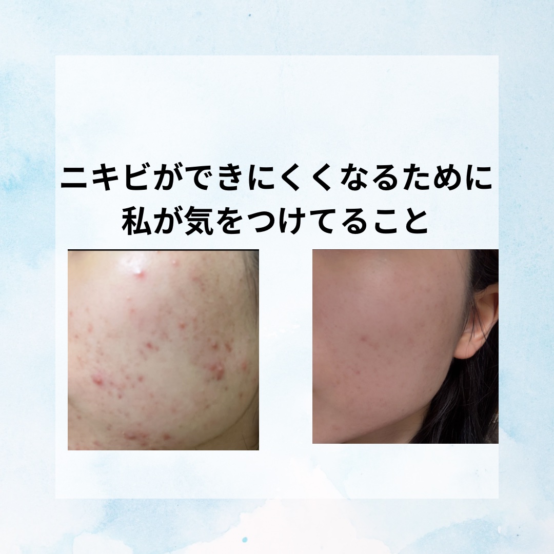 クリアフル ウォッシュ/オルビス/洗顔フォームを使ったクチコミ（1枚目）