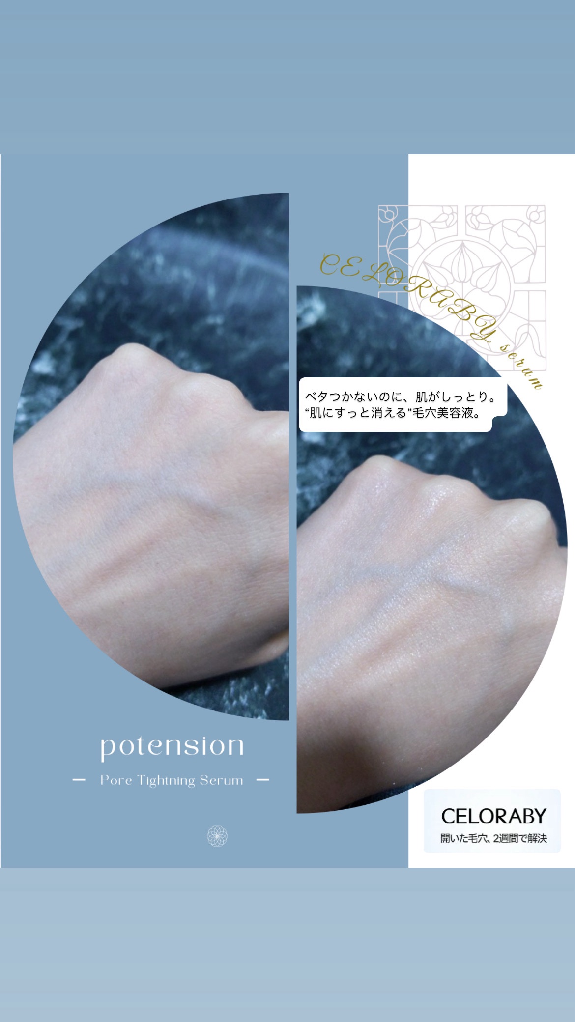 ポアタイトニングブーストセラム/CELORABY/美容液を使ったクチコミ（3枚目）