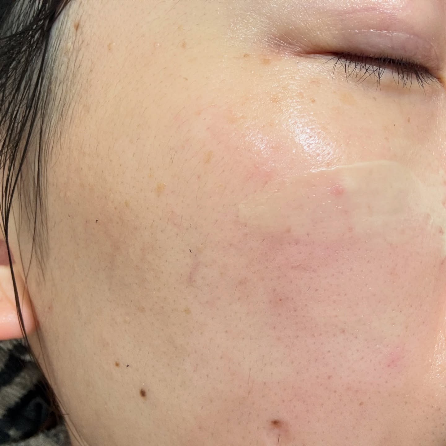 ドクタージャルト シカペア クリーム （第2世代）/Dr.Jart＋/フェイスクリームを使ったクチコミ（3枚目）