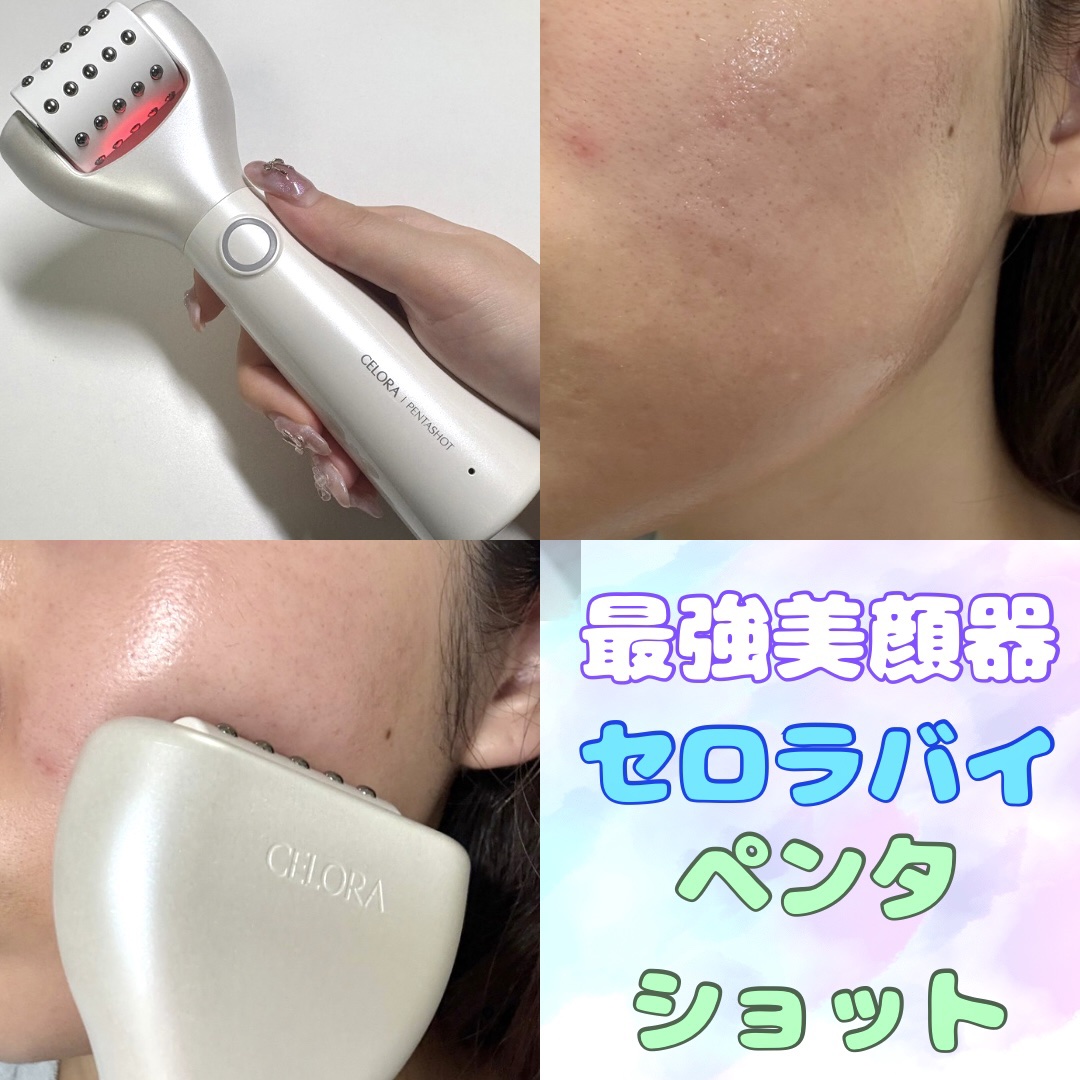 ペンタショット/CELORABY/美顔器・マッサージを使ったクチコミ（1枚目）