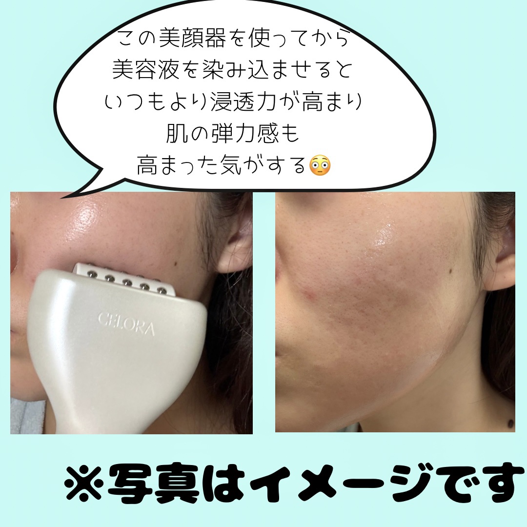 ペンタショット/CELORABY/美顔器・マッサージを使ったクチコミ（3枚目）