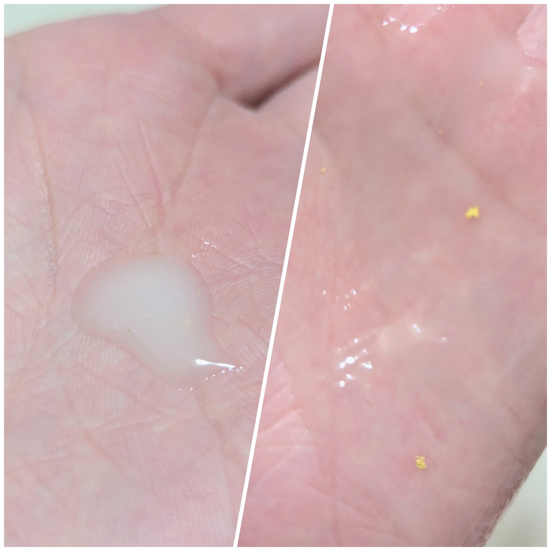 ブラックトリュフ リードルショット 100/VT/美容液を使ったクチコミ（2枚目）