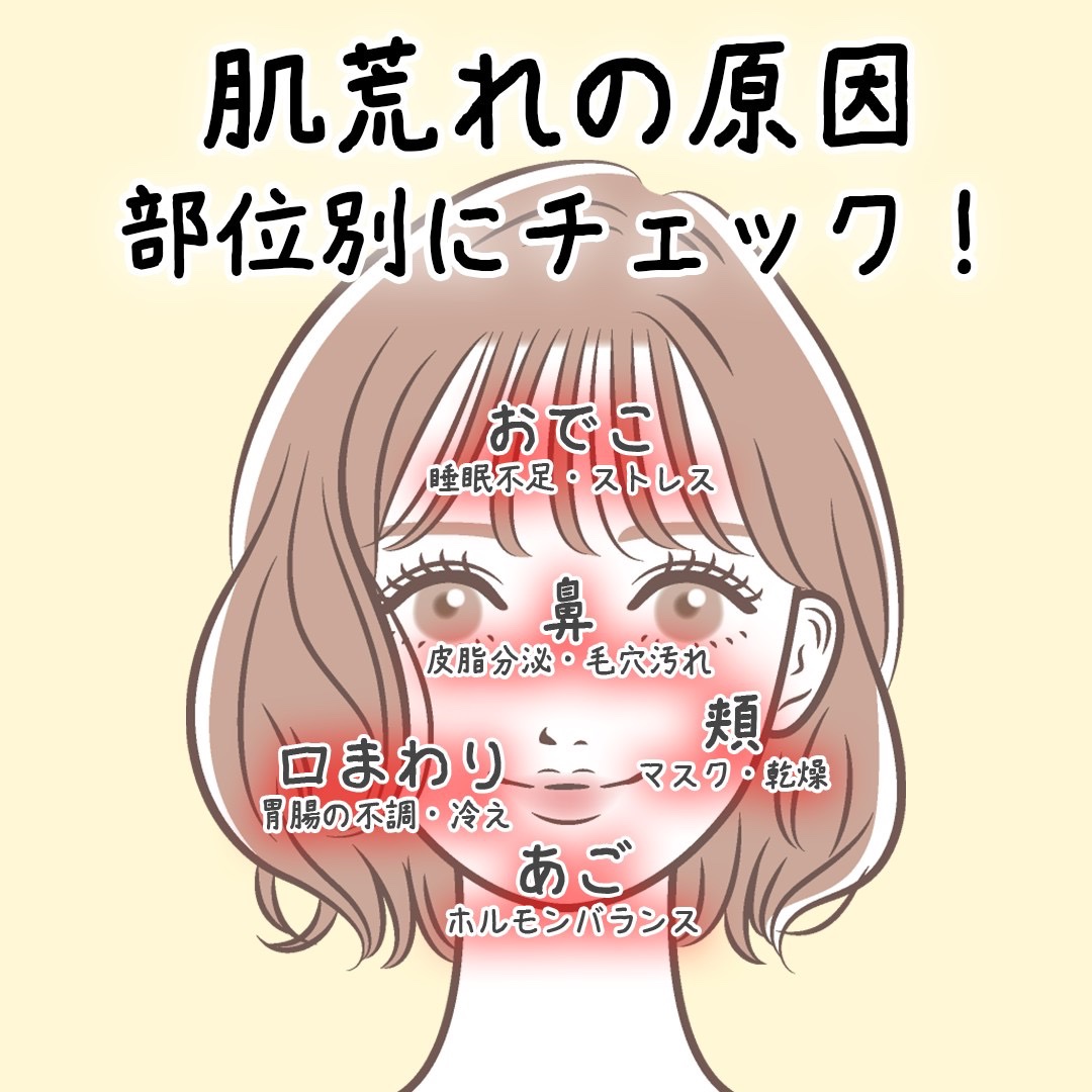 青麦ジンクセラム/Veganifect/美容液を使ったクチコミ（3枚目）