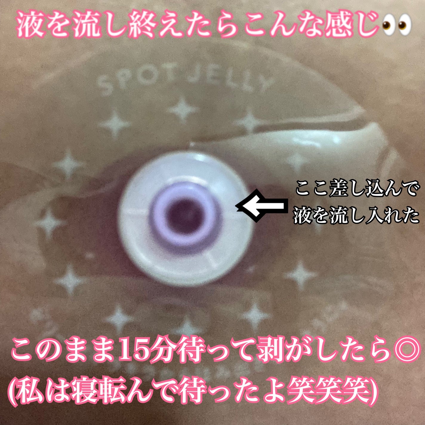 SPOT JELLY(スポッ!とジェリー)へそごまパック/花王/その他スキンケアを使ったクチコミ(5枚目)