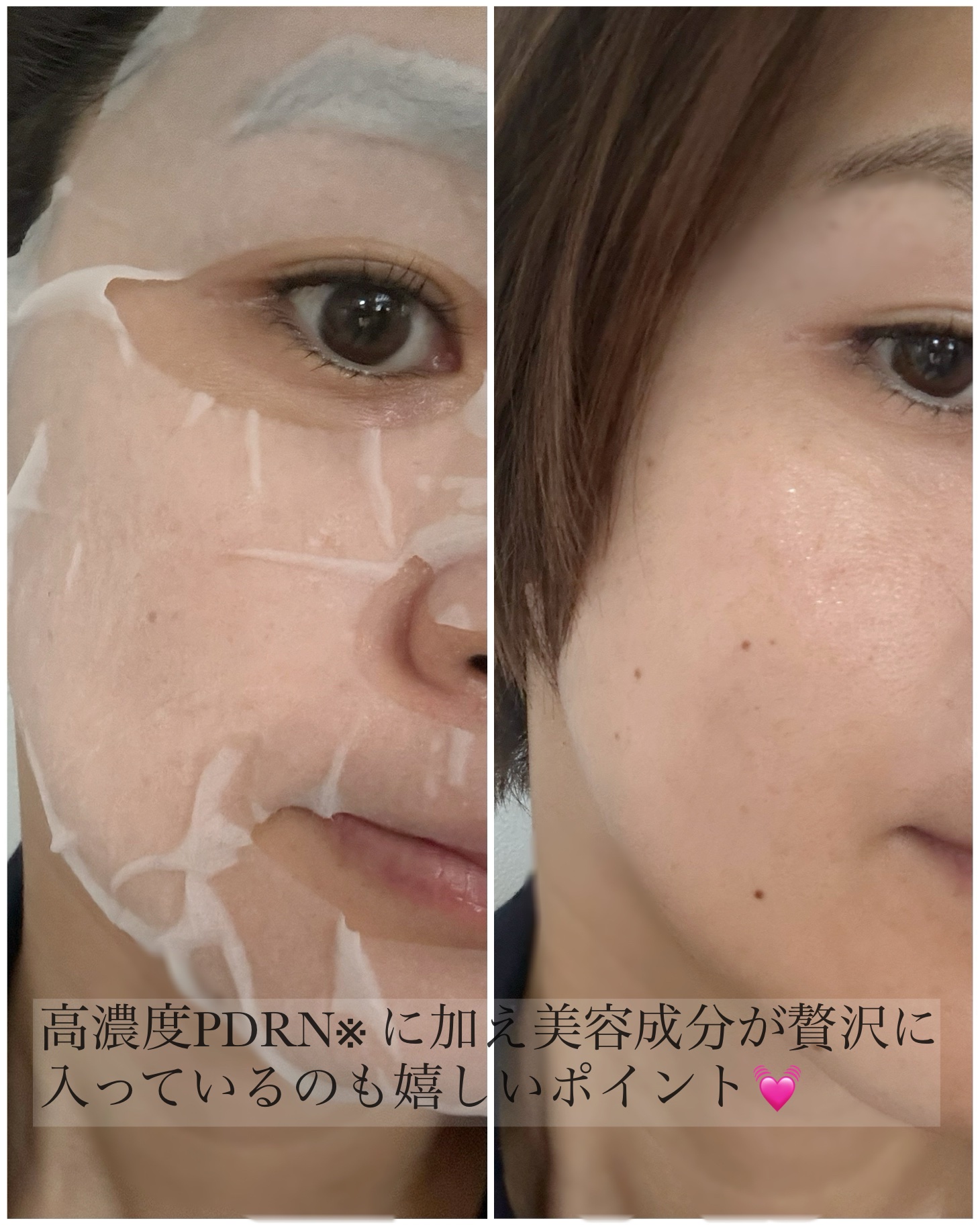 ブラックPDRN デイリーシートマスク/ネイチャーリパブリック/シートマスク・パックを使ったクチコミ（2枚目）