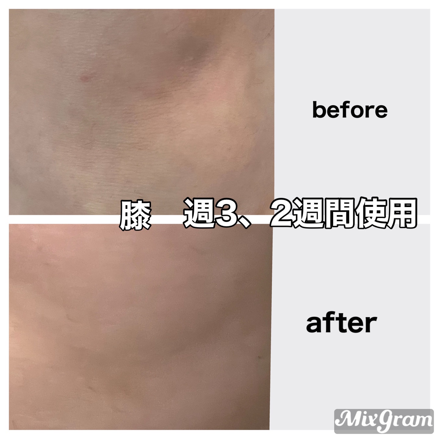 BnD マシュマロ コラーゲン AHA スクラブ /BnD/ボディスクラブを使ったクチコミ（3枚目）