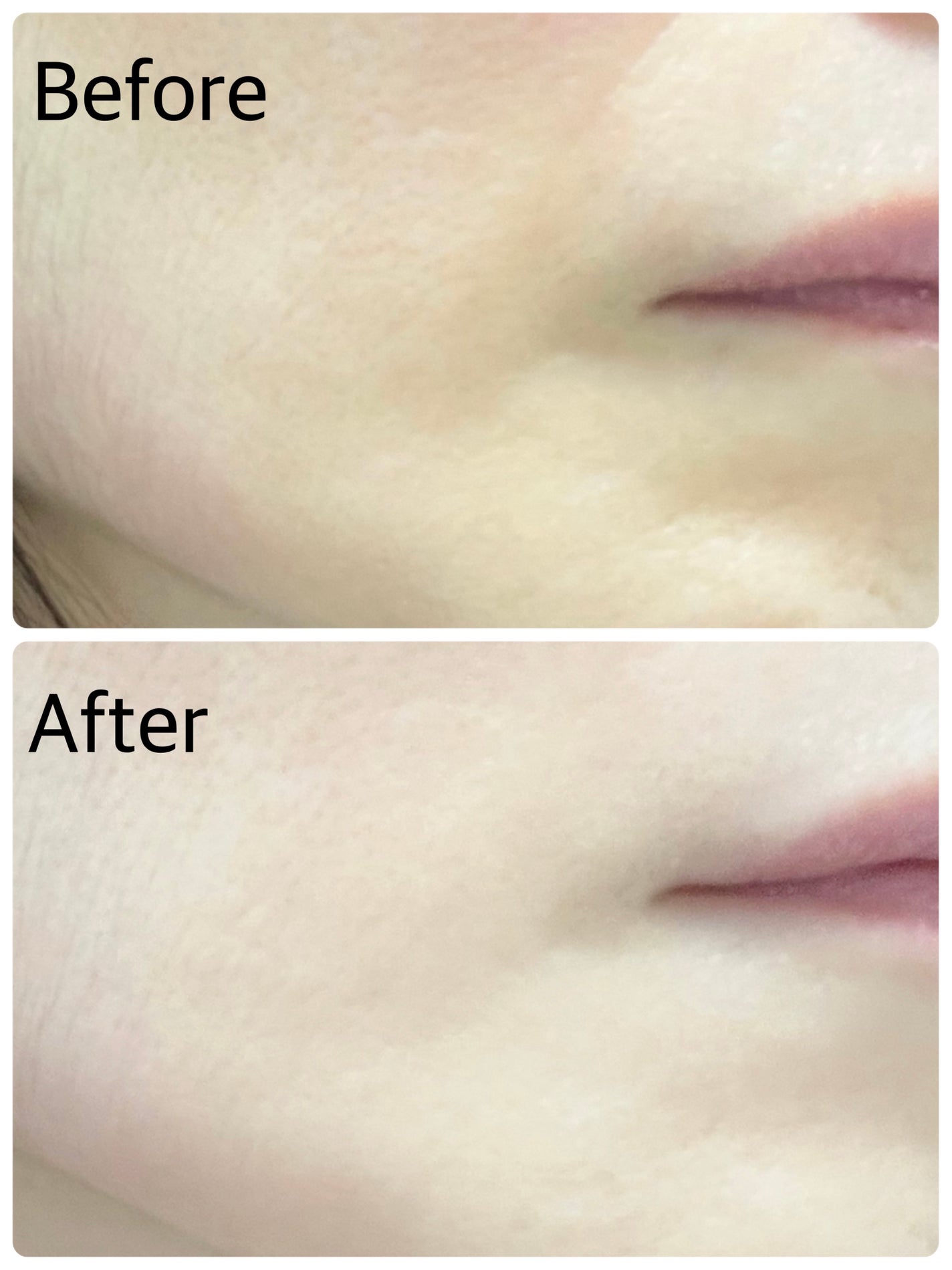 グルタチオンフィルムコラーゲンマスク/Abib /シートマスク・パックを使ったクチコミ(5枚目)