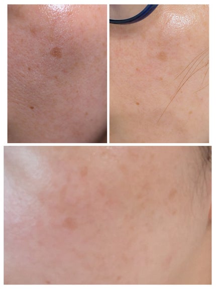 を使ったクチコミ(1枚目)