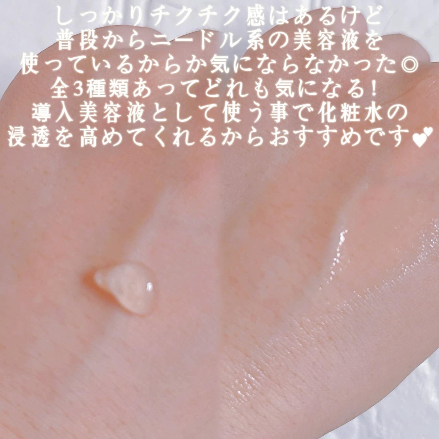 ニードルセラム グルタチオン/LEPOREM/美容液を使ったクチコミ(3枚目)