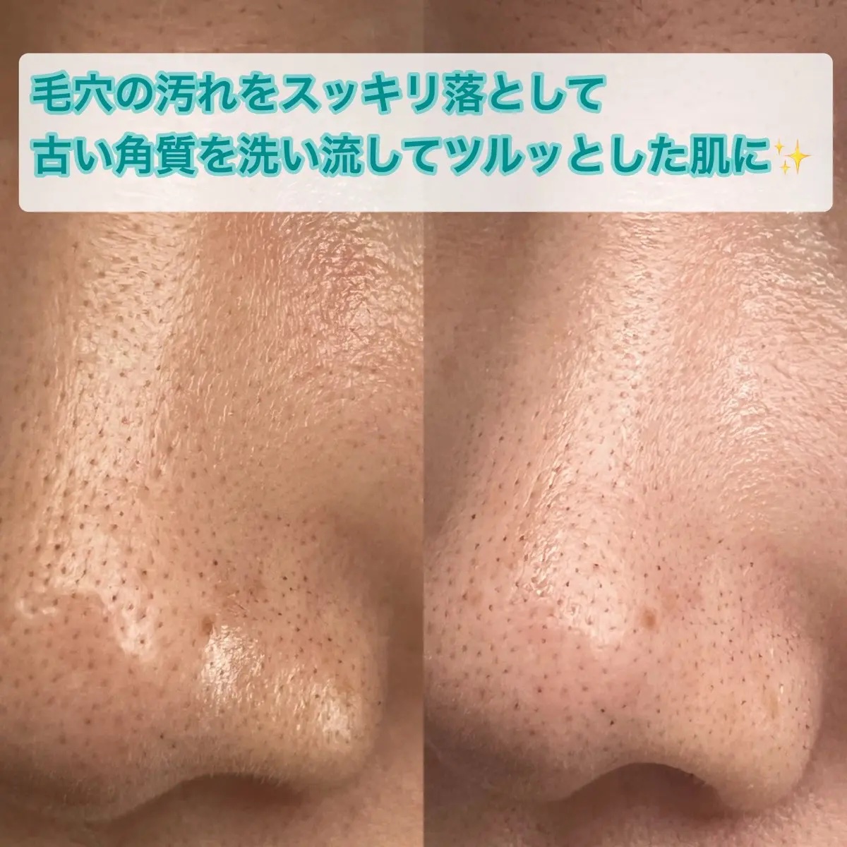 BnD マシュマロ コラーゲン AHA スクラブ /BnD/ボディスクラブを使ったクチコミ（3枚目）