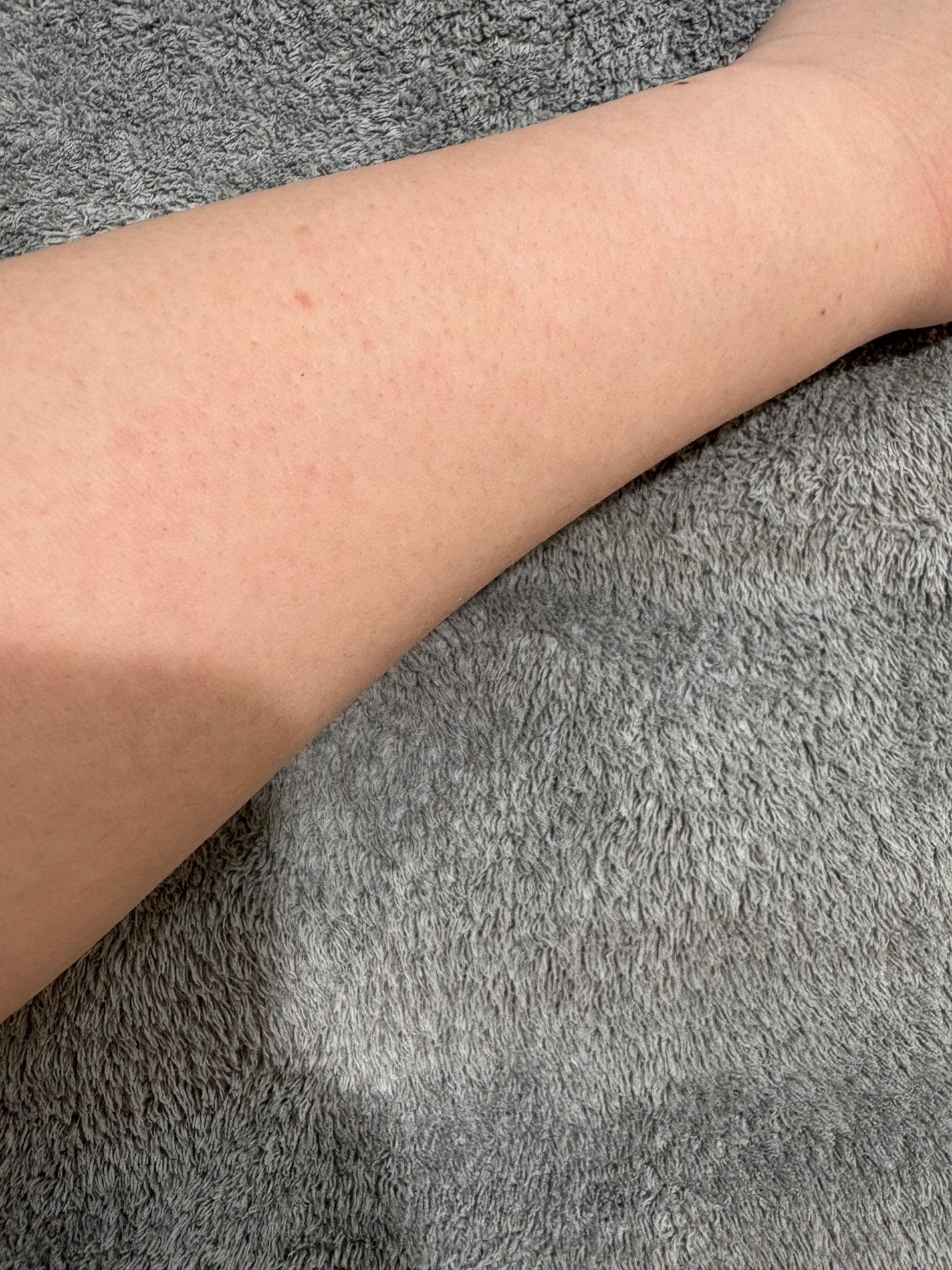 ð°éããŠèŠã«ããæçš¿ãã¿ãŸããå麻 on LIPS ãããã°ãã¯ä»æ¥ã¯ãºãã©éããç§ãèŠããŸãã®ã§é²èŠ§æ³šæã§ãâŠäœæ¯..ãïŒ5æç®ïŒ