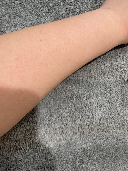 ð°éããŠèŠã«ããæçš¿ãã¿ãŸããå麻 on LIPS ãããã°ãã¯ä»æ¥ã¯ãºãã©éããç§ãèŠããŸãã®ã§é²èŠ§æ³šæã§ãâŠäœæ¯..ãïŒ5æç®ïŒ