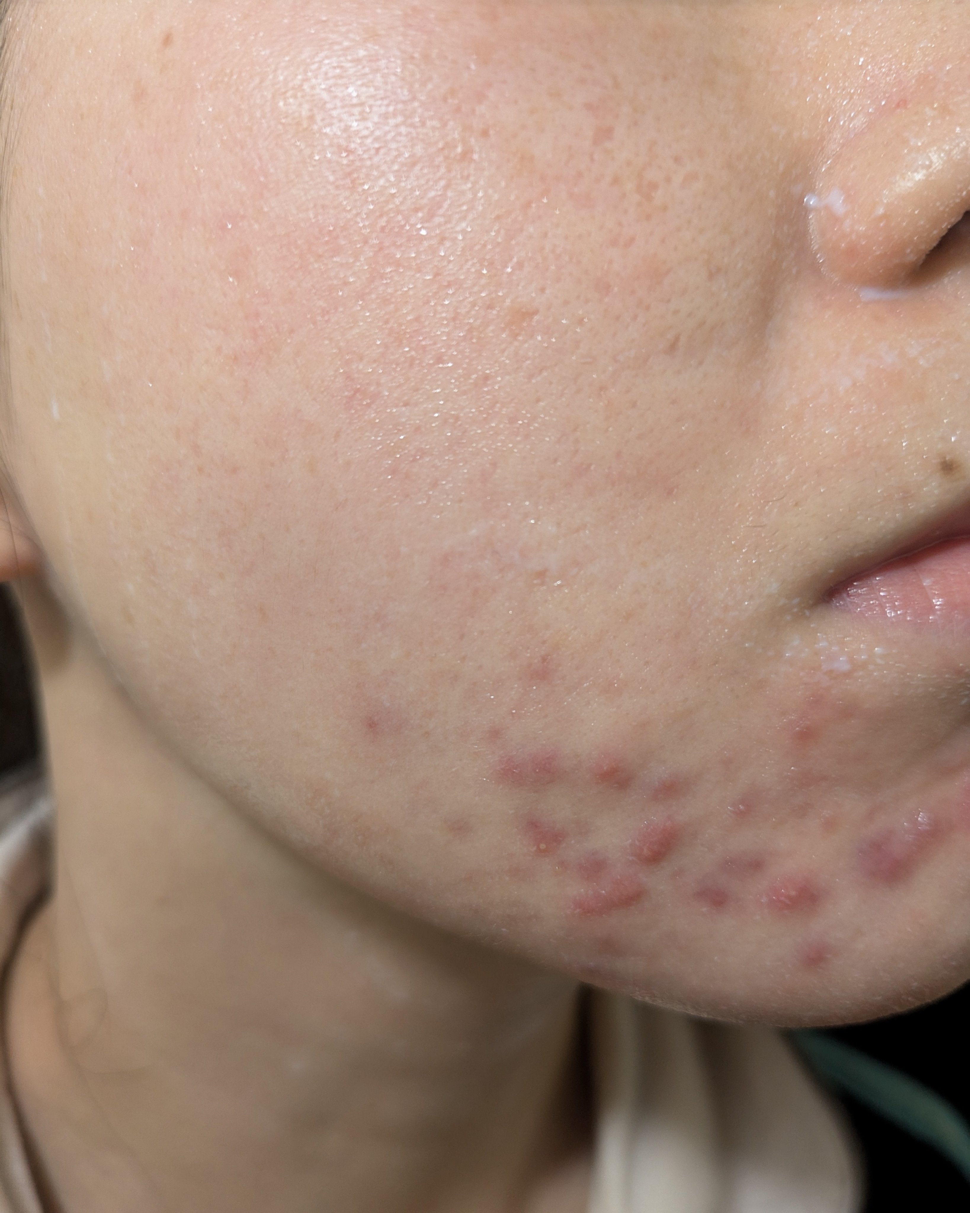 12/30の#汚肌工事録

😂😂