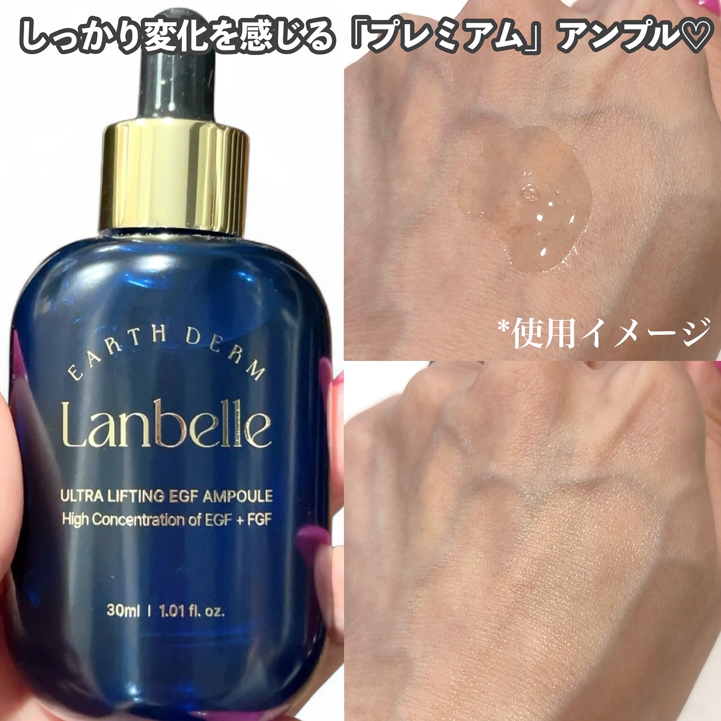 LANBELLE ウルトラリフティングEGFアンプルのクチコミ「Lanbelle
Ultra Lifting EGF Ampoule



しっかり変化を感じ.....」（2枚目）