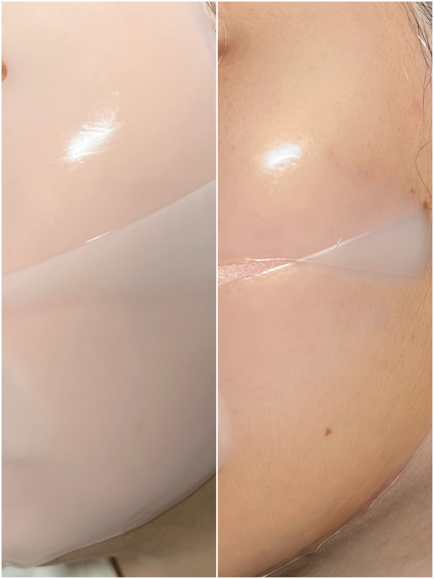 NI【韓国コスメオタク】 on LIPS 「⌇cosrx︎▶︎RXザアルファアルブチン2ニキビ跡ケアセラム..」(6枚目)