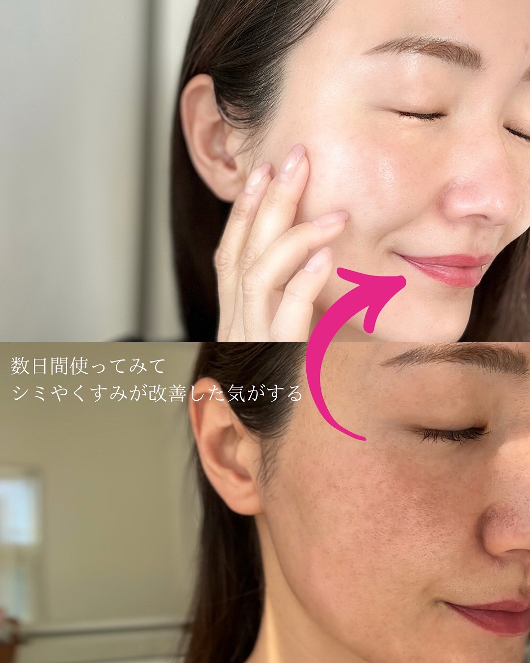 アルブチン スキンブースター セラム/MEDITHERAPY/美容液を使ったクチコミ（3枚目）