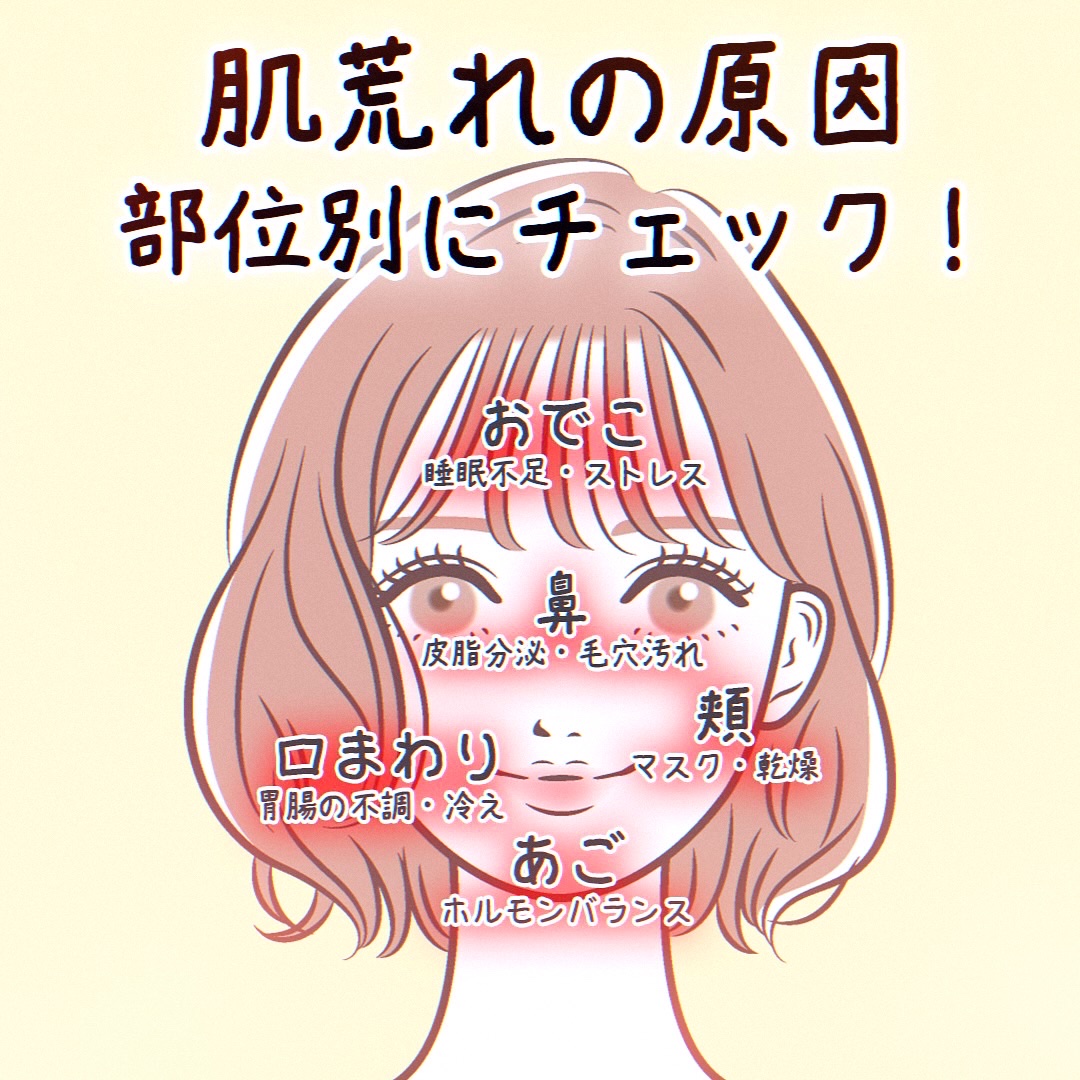 青麦ジンクセラム/Veganifect/美容液を使ったクチコミ（3枚目）