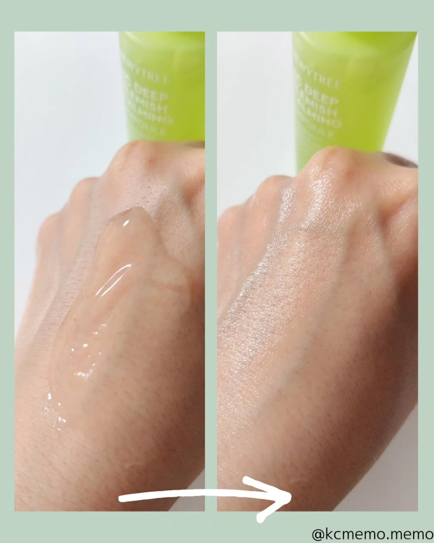 痕跡カーミングアンプル/DEWYTREE/美容液を使ったクチコミ(4枚目)