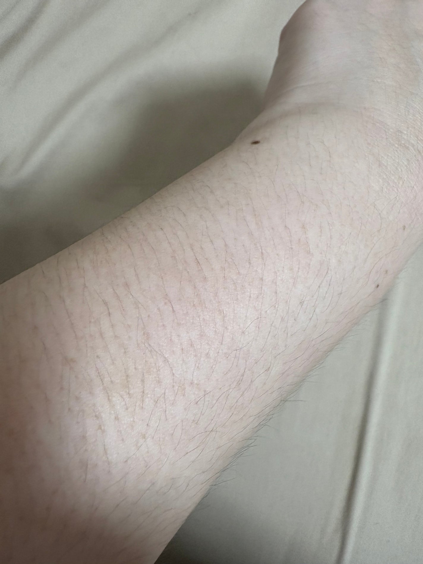 ð°éããŠèŠã«ããæçš¿ãã¿ãŸããå麻 on LIPS ãããã°ãã¯ä»æ¥ã¯ãºãã©éããç§ãèŠããŸãã®ã§é²èŠ§æ³šæã§ãâŠäœæ¯..ãïŒ2æç®ïŒ