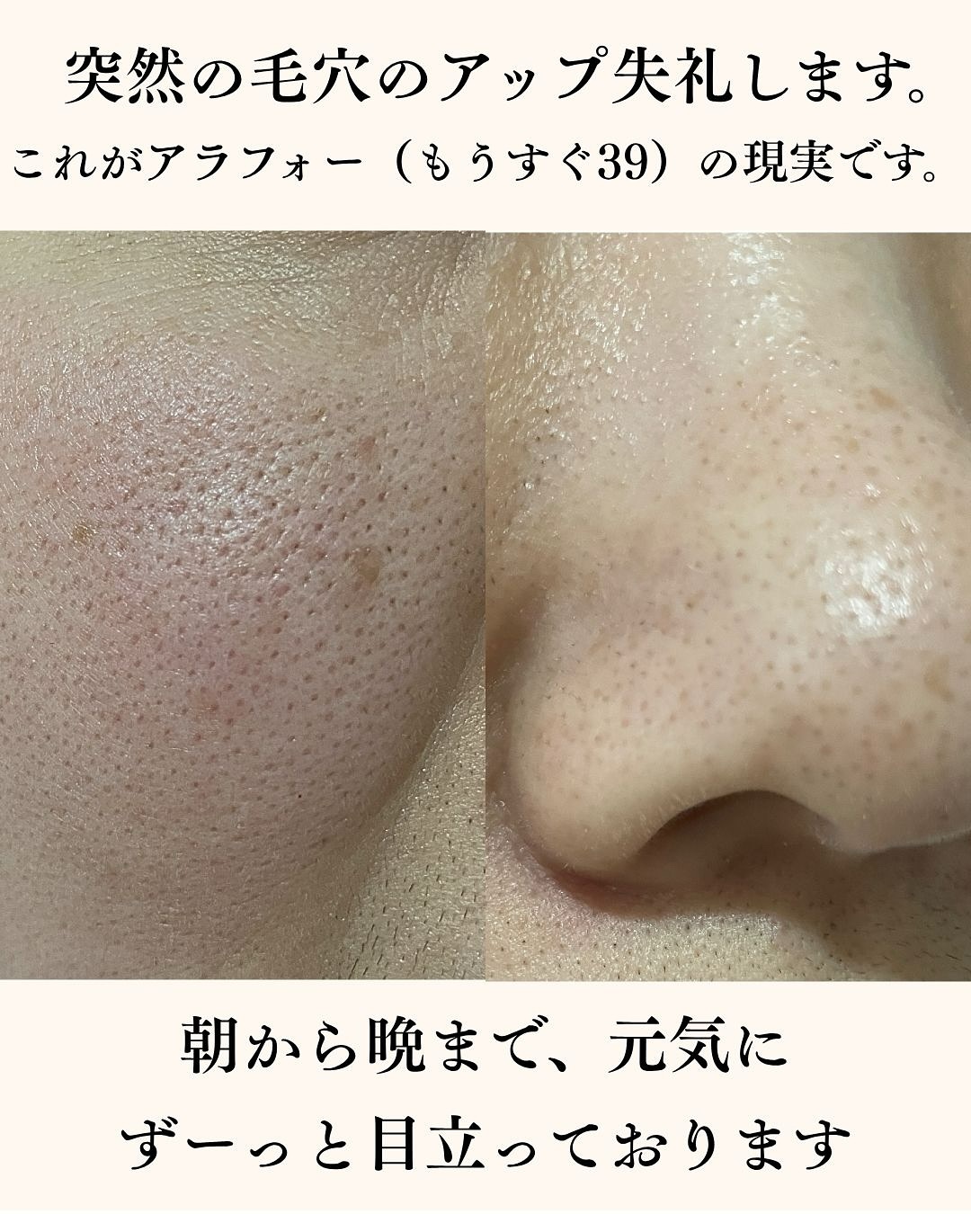 ディズム　スクラブクリームウォッシュ ブラック/DISM/洗顔フォームを使ったクチコミ（2枚目）