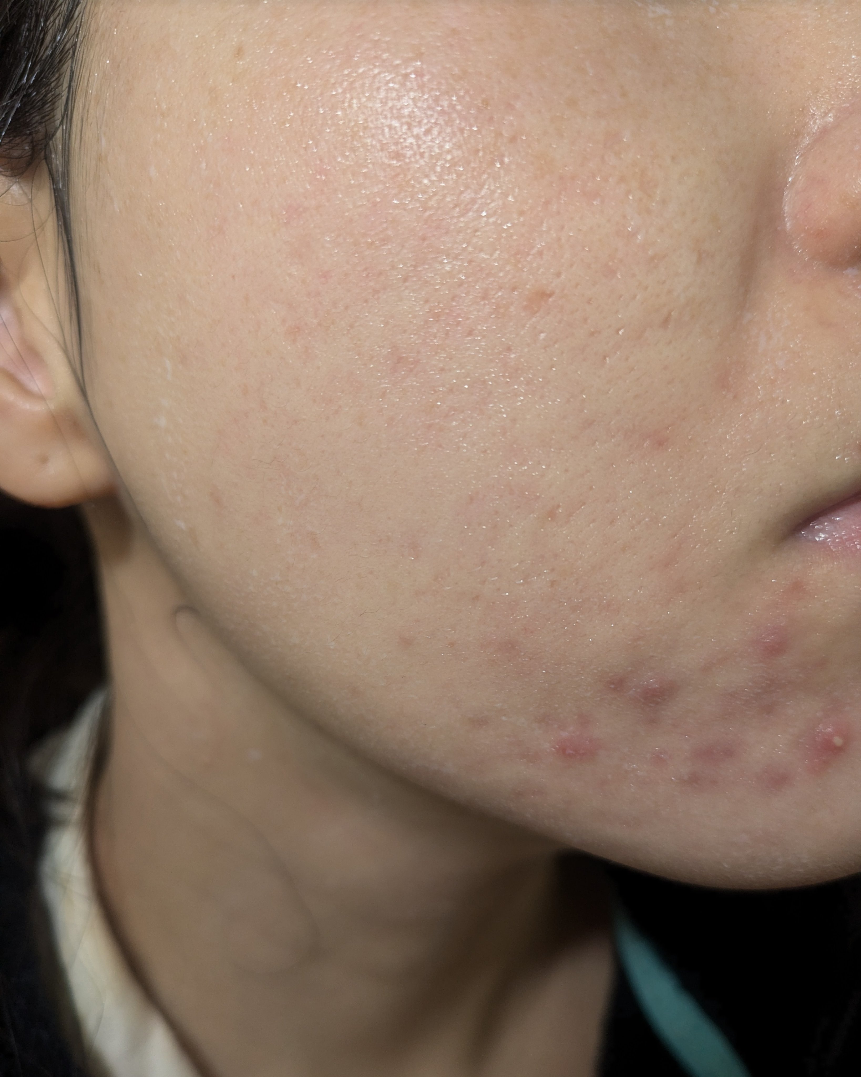 12/6-12/12の#汚肌工事録