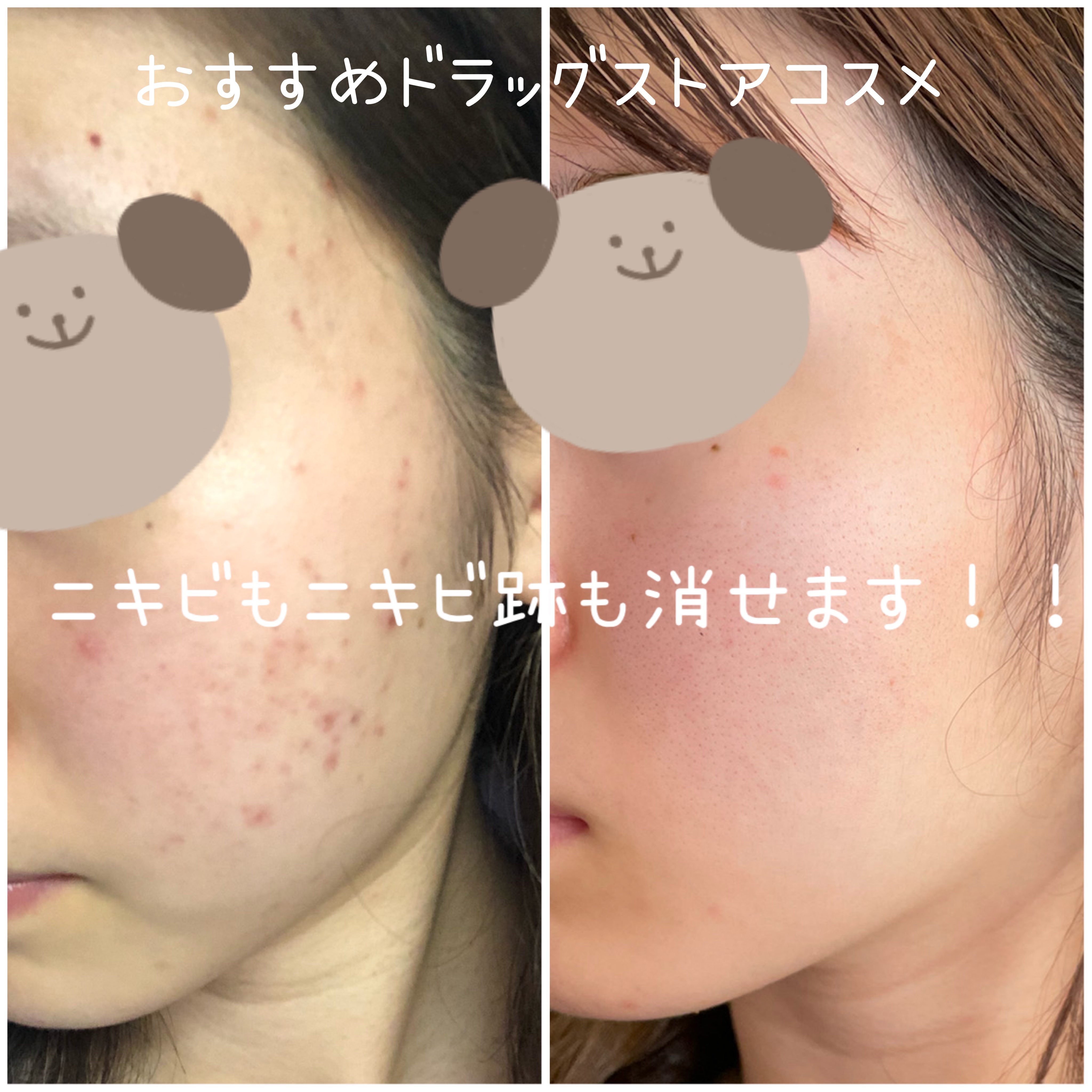 オードムーゲ 薬用ローション（ふきとり化粧水）/オードムーゲ/拭き取り化粧水を使ったクチコミ（1枚目）