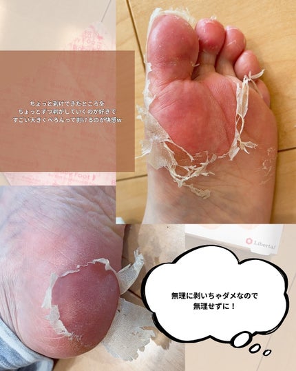 ベビーフット/リベルタ/その他キットセットを使ったクチコミ(3枚目)