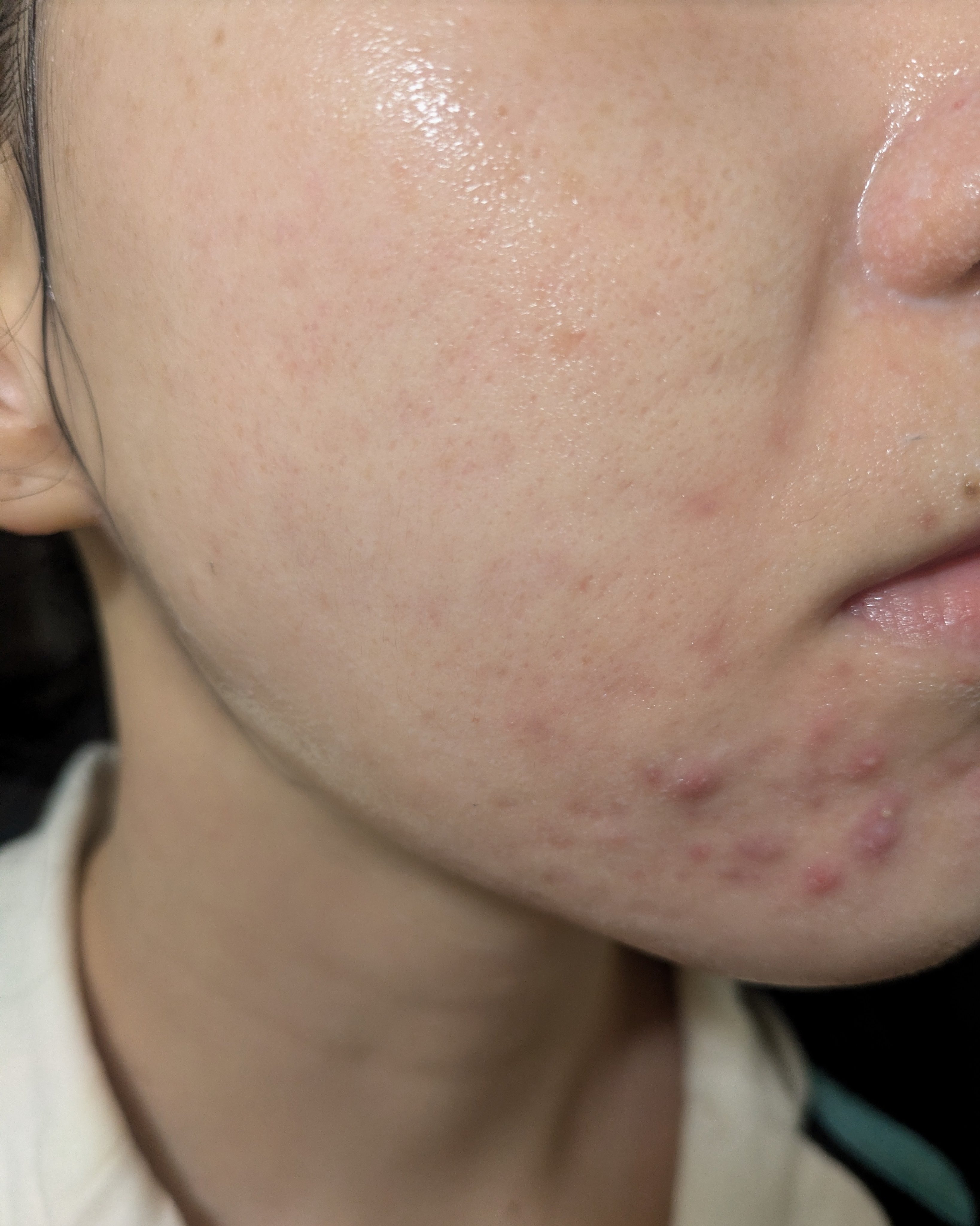 12/1-12/5の#汚肌工事録

