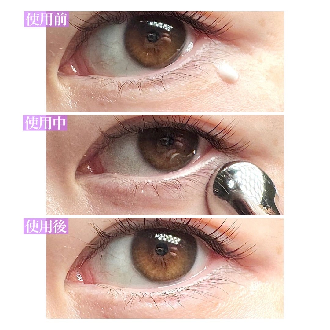 BAKUCHI NEEDLE SHOT DARK CARE AUTO EYE CREAM/LIALUSTER/アイケア・アイクリームを使ったクチコミ(5枚目)