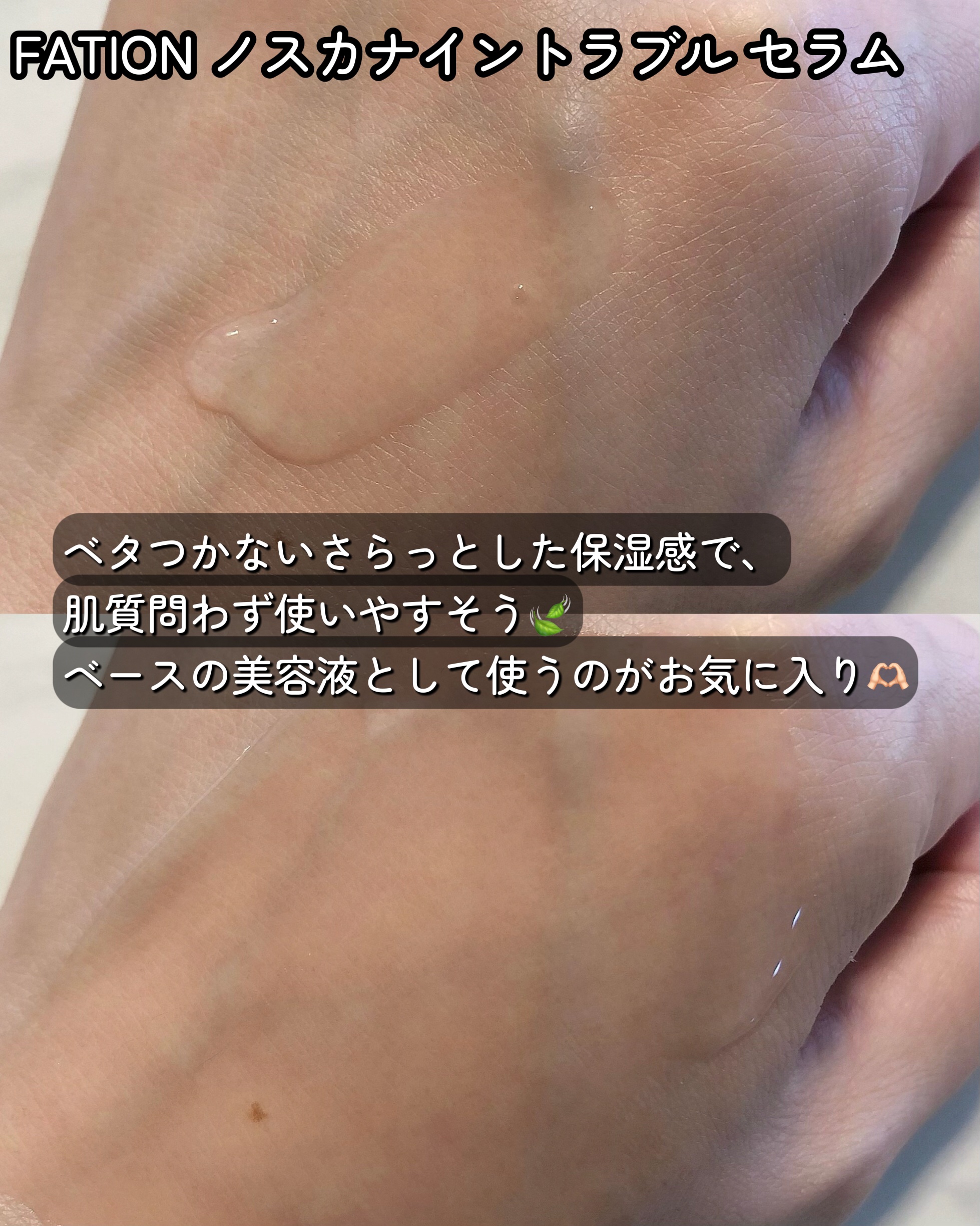 ノスカナイン トラブル セラム/FATION/美容液を使ったクチコミ（3枚目）