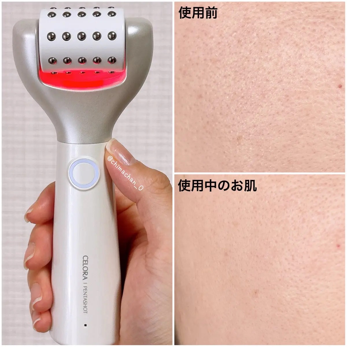 ペンタショット/CELORABY/美顔器・マッサージを使ったクチコミ（3枚目）