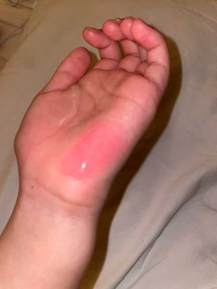 フィー 3Dボリューミンググロス/fwee/リップグロスを使ったクチコミ(2枚目)