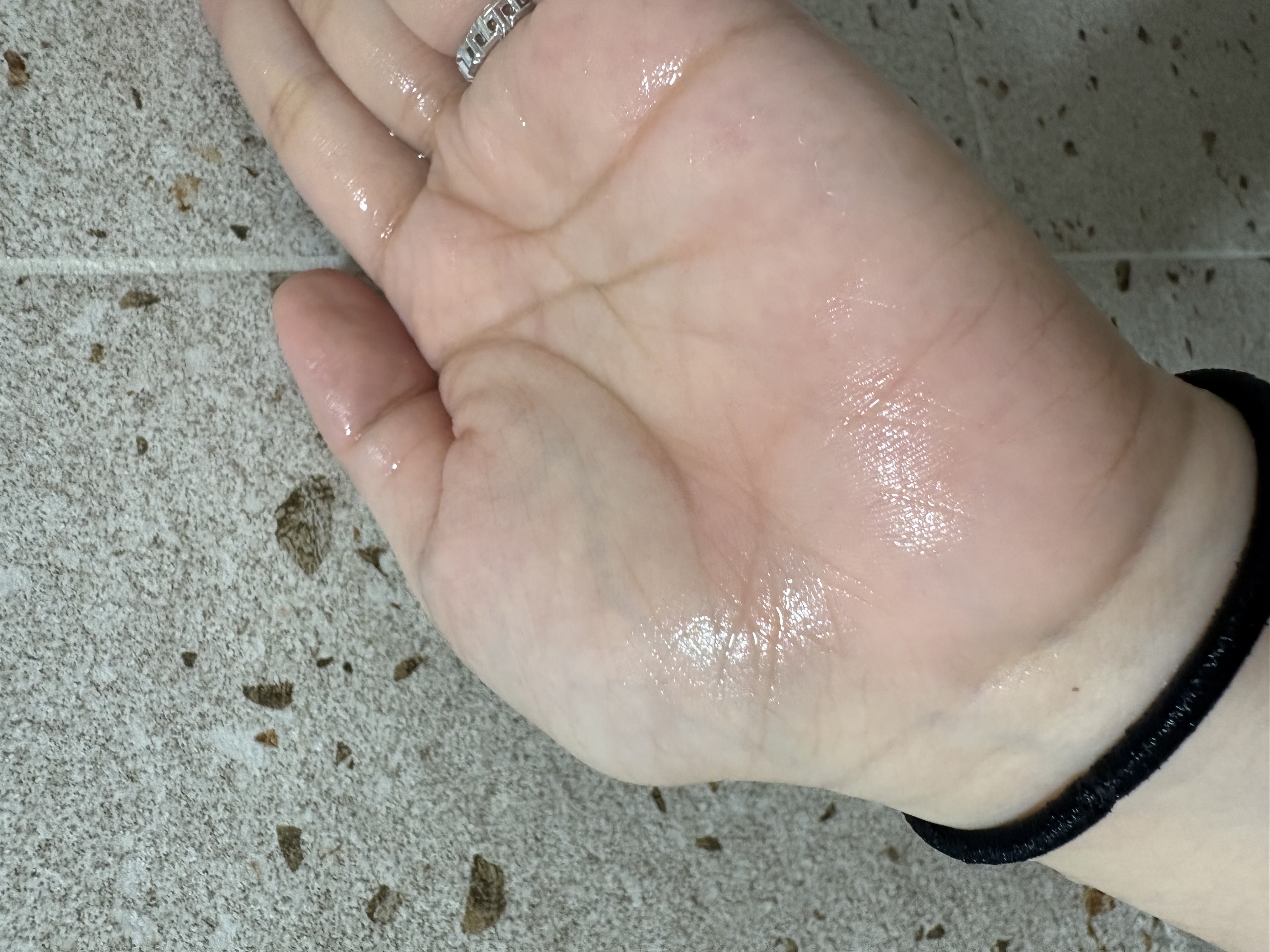 フォルテ アンプル トリートメント/treecell/洗い流すヘアトリートメントを使ったクチコミ（3枚目）