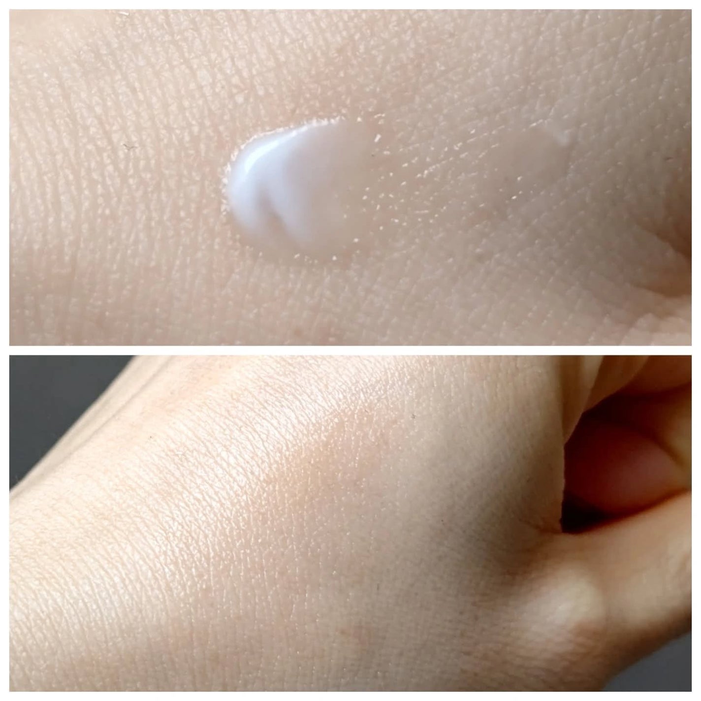 BAKUCHI NEEDLE SHOT DARK CARE AUTO EYE CREAM/LIALUSTER/アイケア・アイクリームを使ったクチコミ(2枚目)