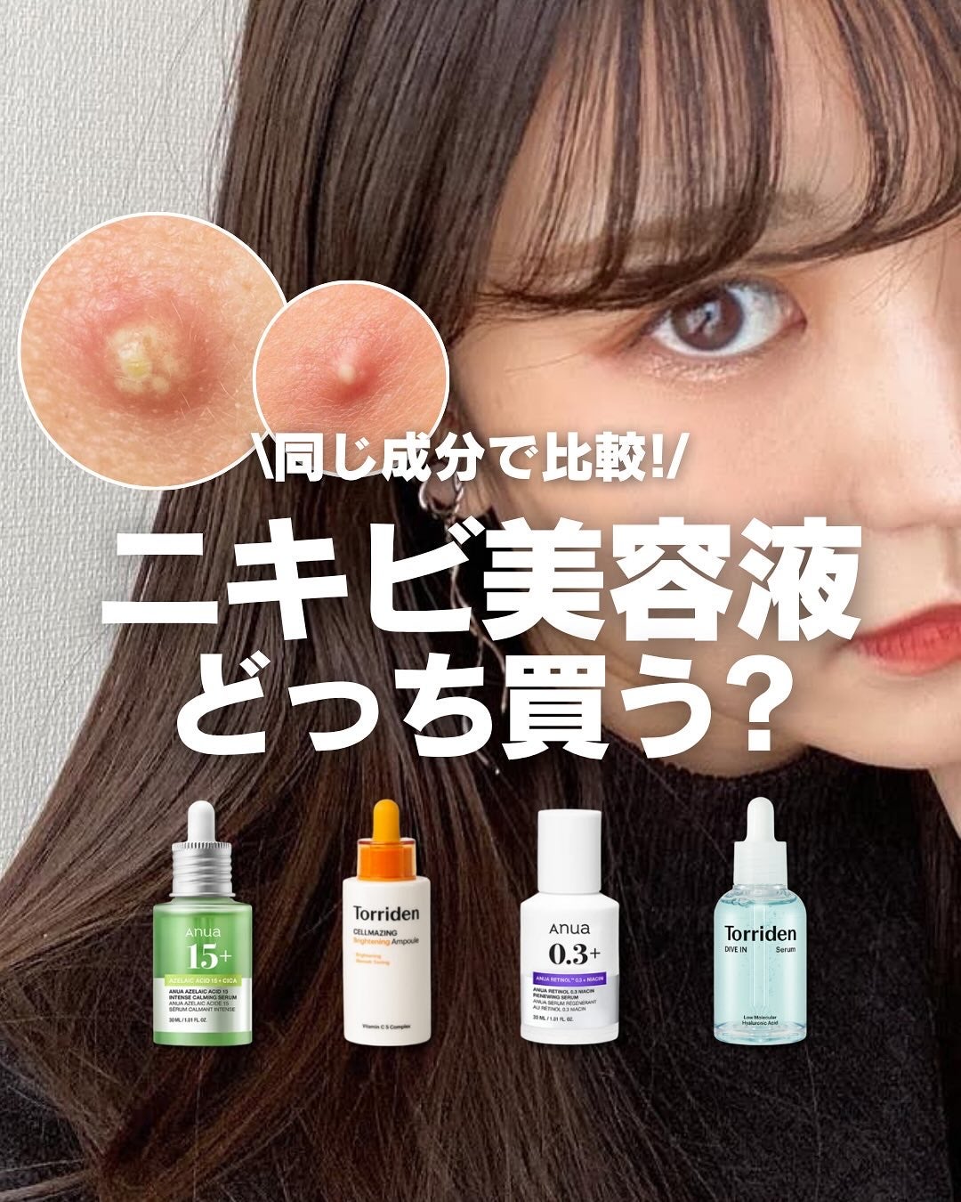 白湯(サユ) | ニキビと戦うOL🤍 on LIPS 「絹です🌿「アゼライン酸のアイテム多すぎてどれ選べばいいかわから..」(1枚目)