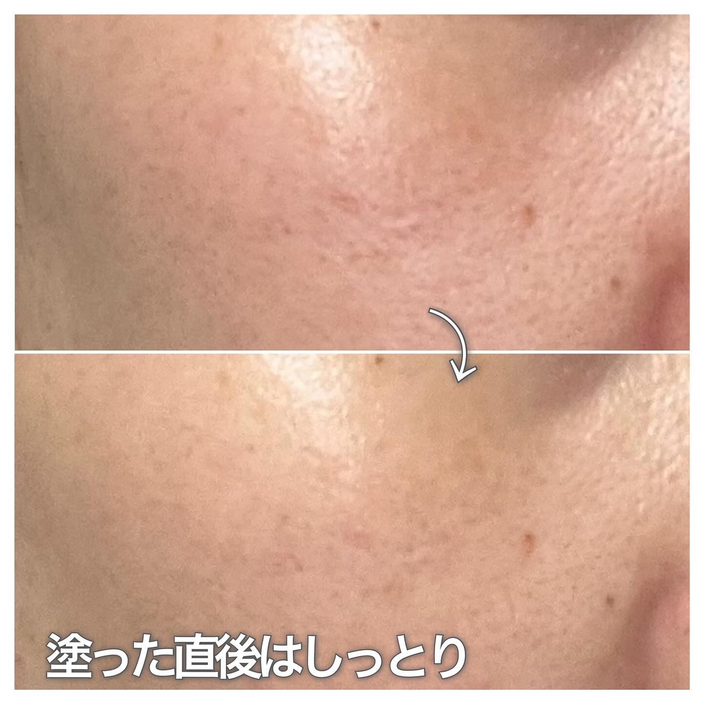 ビタ5X コラーゲン クリーム ミスト/D'amu/ミスト状化粧水を使ったクチコミ（3枚目）