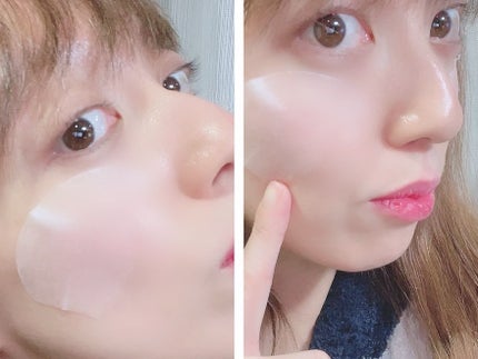 ゆいちゃま。 on LIPS 「韓国で大人気の保湿系スキンケアアイテムSKIN1004(スキン..」(4枚目)